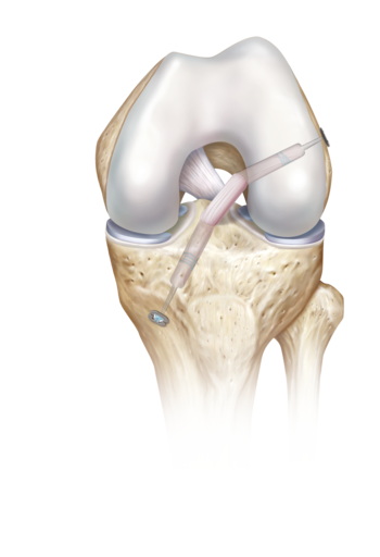 Arthrex Helping Surgeons Treat Their Patients Better™