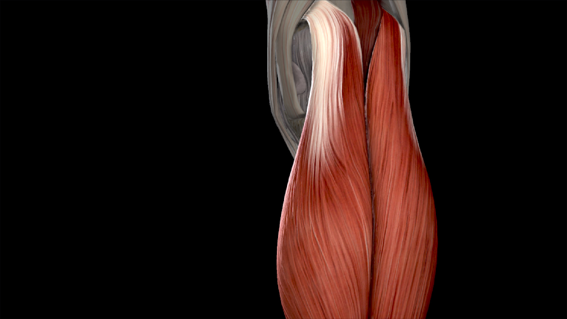 Anatomy of the Gastrocnemius With Equinus Contracture
